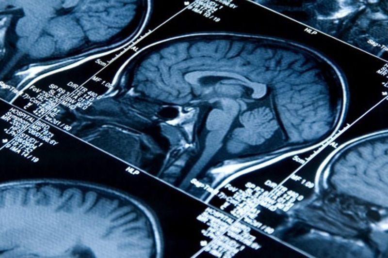 How smartphone technology is being used to combat memory loss [CTV News]
